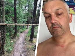 Cyclist ripped from bike by wire trap stretched across trail at head height 