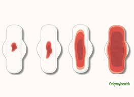 Implantation bleeding tends to occur around when you expect your next period. What Is Ovulation Bleeding Know About This Condition From Gynaecologist