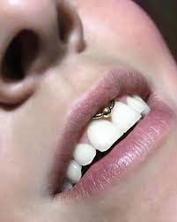 Smiley Piercing Idea In 2021 Smiley Piercing Piercings Piercing