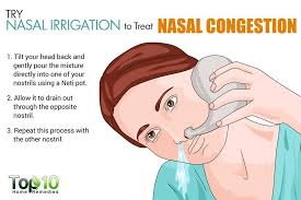Home Remedies For Nasal Congestion Top 10 Home Remedies In 2020 Nasal Congestion Chest Congestion Remedies Chest Congestion