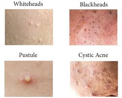 Pin On Skin Care For Mom