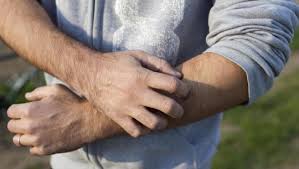 Kollarda Kasinti Nedenleri Ve Tedavisi Multi Yasam