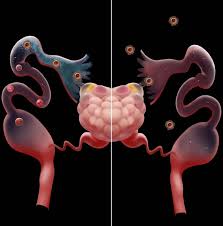 The fallopian tubes are tubes present in women (and female mammals) that serve an extremely important purpose in fertilization. Lundquist Investigator Wei Yan Solves Longstanding Fallopian Tube Transport Debate Eurekalert Science News