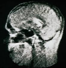 Ankle tendon imaging is important in the context of acute and chronic painful syndroms. Mrt Wie Alles Begann Mta R De