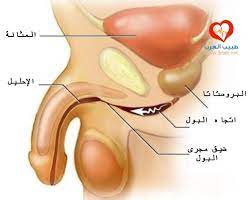 أسباب ضيق مجرى البول وعلاجه
