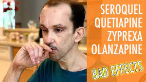 Raised levels of cholesterol and triglycerides in the blood. Warning Do Not Take These Drugs Seroquel Quetiapine Zyprexa Olanzapine Youtube