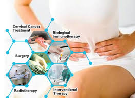 Kanser serviks telah tumbuh ke organ sekitarnya atau merebak lebih jauh ke dalam badan (metastasis jauh). Jual Ubat Herba Untuk Kanser Serviks Tahap 4