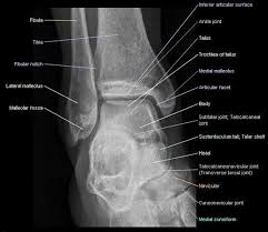 Arteries And Bones Of The Lower Extremity Interactive Atlas Of Human Anatomy Radiology Student Medical Anatomy Radiology
