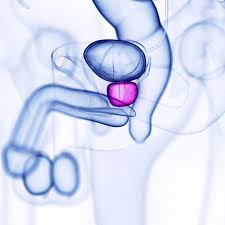 If breast cancer is diagnosed at an early enough stage, it's treatable. A Guide To Prostate Massage Medical And Sexual Uses