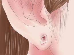 How To Take Care Of Pierced Ears Ear Piercing Care Ear Peircings New Ear Piercing