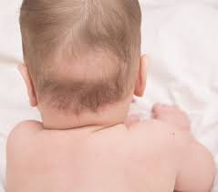 In fact, you usually lose about 100 hairs from your head on any given day. Why Does My Baby Have A Bald Spot On The Back Of Their Head It S A Pretty Simple Reason