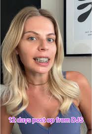 Double Jaw Surgery Recovery Update 12 Days Post-Op