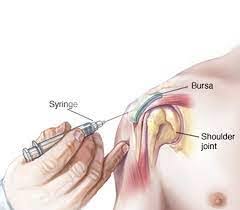 Image result for Shoulder Injection