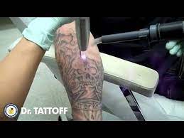 Oxford board certified plastic surgeon dr. Laser Tattoo Removal Jackson Ms Video Dailymotion