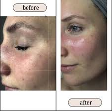 TOP 10 BEST Facial near Rockridge, Oakland, CA