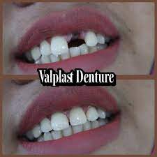 We did not find results for: Dokter Gigi Surabaya Drg Riesqi Startseite Facebook