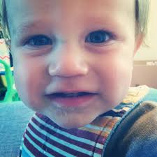 Life-threatening peanut allergy