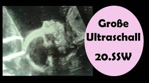 Ssw » das passiert in der 20. Grosse Ultraschall Untersuchung 20 Ssw Ultraschall Schwangerschaft Kindsbewegungen Youtube