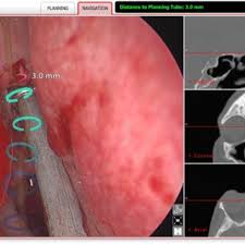 You'll benefit from the knowledge and experience of find care for a full range of conditions affecting the ear, nose, throat and related structures of the head and neck, including Pdf Rhinology Simulation Training Part 1