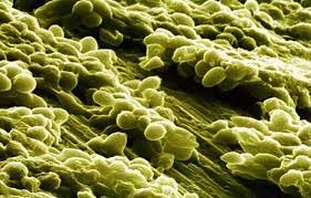 Maybe you would like to learn more about one of these? Protein Sel Tunggal Scp