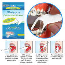 The traditional flossing technique can often be difficult for those with braces as the user has to thread the floss under the wire of the braces to get in between teeth and gums. Platypus Orthodontic Flosser The Ortho Box