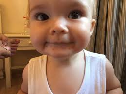 Baby girl rushed to hospital with hand, foot and mouth disease