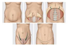 Pin On Cosmetic Surgery