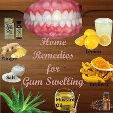 Pin On Teeth