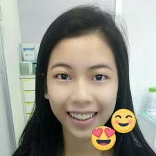 Braces Take Off Call Us For Free Klinik Pergigian Dr Azreen Sungai Petani Facebook