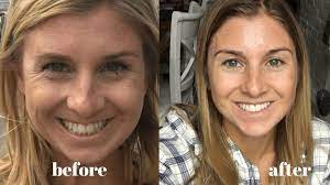 Very few supplements have real research studies to show benefits (b. Vital Proteins Review Before And After Picture Too