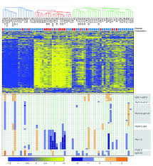 From my expressions series produced way back in 2007! Epstein Barr Virus Associated Primary Nodal T Nk Cell Lymphoma Shows A Distinct Molecular Signature And Copy Number Changes Haematologica