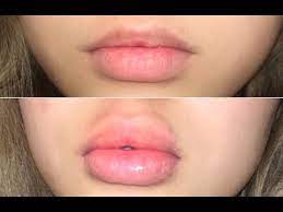 The key to plump lips is regular exfoliation. How To Grow Your Lips Naturally Darlapimber Youtube