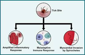 Image result for Lyme Carditis