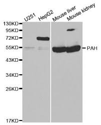 When ready to use, rehydrate with dh2o (50 µl for 100 µg antibody or 250 µl for 500 µg antibody) to make 2 mg/ml solution and. Pah Antibody Mybiosource