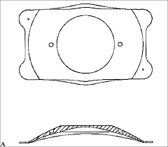 This might provide a good place to start writing an intro course. A B Staar Implantable Contact Lens Staar Surgical Ag Nidau Download Scientific Diagram