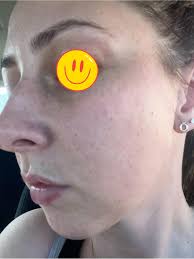 Please house help with idea I have white dots