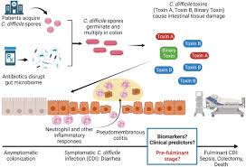 Image result for Clostridioides difficile