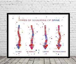 Type Of Scoliosis Of Spine Spine Scoliosis Scoliosis Of Etsy Anatomy Art Scoliosis Free Prints