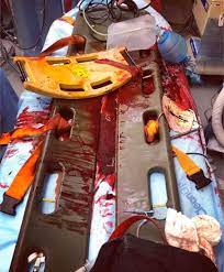 Maybe you would like to learn more about one of these? Gsw Trauma Room Aftermath Patient Survived Medizzy