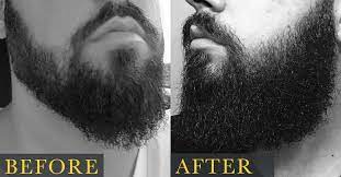 Dirt, oil and dead skin can clog those tiny pores and keep hair follicles from breaking through. How To Grow A Beard The Right Way