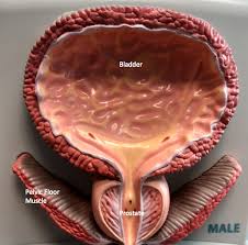 Image result for Radical Prostatectomy