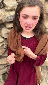 Penny Feeding Gofundme