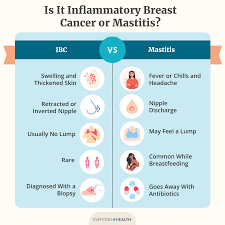 Image result for Inflammatory breast cancer