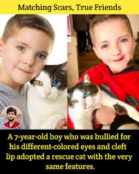 Bullied for His Different Eyes & Cleft Lip