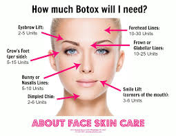 How Much Botox Will I Need Botox Cosmetic Botox