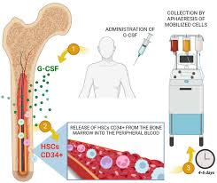 Image result for Apheresis