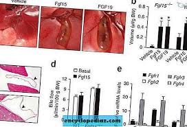 Bila tiada detoksifikasi, seperti yang berlaku dalam saluran hempedu dan kesesakan pundi hempedu, kepekatan yang berlebihan dalam darah menyebabkan pembengkakan tisu dan juga water retention dalam badan.tahap estrogen yang tinggi juga dianggap sebagai punca utama daripada kanser payudara di kalangan wanita. Pengenalpastian Asas Hormon Untuk Mengisi Pundi Hempedu Perubatan Semula Jadi Ubat 2021