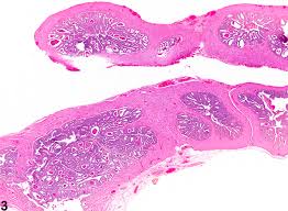 Image result for Seminal Vesicle