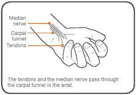 Exercise Advice Carpal Tunnel Syndrome The Chartered Society Of Physiotherapy