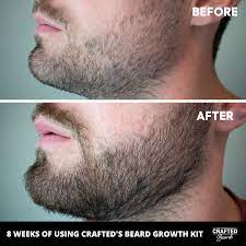 Maybe you would like to learn more about one of these? Beard Roller Crafted Beards